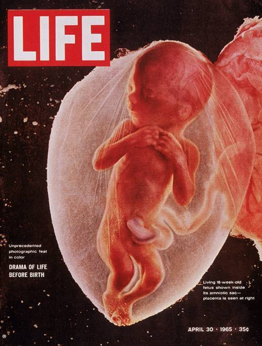 LIFE-Top10Covers-11-oldskull